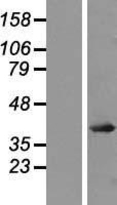 Western Blot: JunD Overexpression Lysate (Adult Normal) [NBP2-07760] Left-Empty vector transfected control cell lysate (HEK293 cell lysate); Right -Over-expression Lysate for JunD.