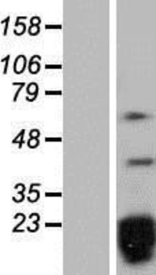 Western Blot: SNRPD2 Overexpression Lysate (Adult Normal) [NBP2-07849] Left-Empty vector transfected control cell lysate (HEK293 cell lysate); Right -Over-expression Lysate for SNRPD2.