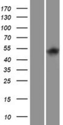 Western Blot: ITPKA Overexpression Lysate (Adult Normal) [NBP2-08138] Left-Empty vector transfected control cell lysate (HEK293 cell lysate); Right -Over-expression Lysate for ITPKA.