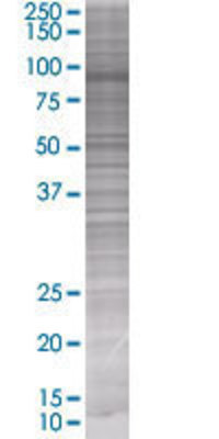 TIAM2 transfected lysate.