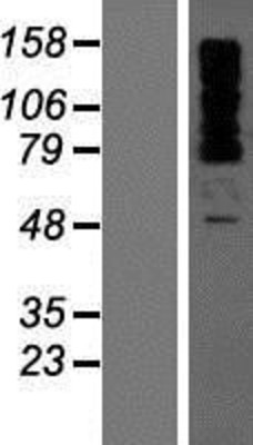 Western Blot: OTUD4 Overexpression Lysate (Adult Normal) [NBP2-08244] Left-Empty vector transfected control cell lysate (HEK293 cell lysate); Right -Over-expression Lysate for OTUD4.