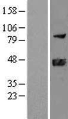 Western Blot: DNAJB11 Overexpression Lysate (Adult Normal) [NBL1-09933] Left-Empty vector transfected control cell lysate (HEK293 cell lysate); Right -Over-expression Lysate for DNAJB11.