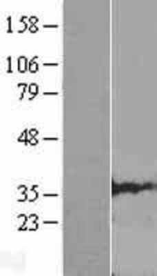 Western Blot: CLDND1 Overexpression Lysate (Adult Normal) [NBL1-09253] Left-Empty vector transfected control cell lysate (HEK293 cell lysate); Right -Over-expression Lysate for CLDND1.