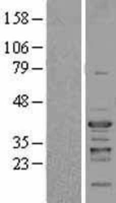 Western Blot: NFYC Overexpression Lysate (Adult Normal) [NBL1-13630] Left-Empty vector transfected control cell lysate (HEK293 cell lysate); Right -Over-expression Lysate for NFYC.