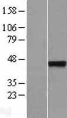 Western Blot: Synaptotagmin 5 Overexpression Lysate (Adult Normal) [NBL1-16653] Left-Empty vector transfected control cell lysate (HEK293 cell lysate); Right -Over-expression Lysate for Synaptotagmin 5.