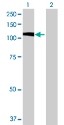 Lane 1: OSBPL5 transfected lysate (96.8 KDa) Lane 2: Non-transfected lysate.