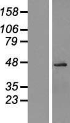 Western Blot: Ogg1 Overexpression Lysate (Adult Normal) [NBP2-09881] Left-Empty vector transfected control cell lysate (HEK293 cell lysate); Right -Over-expression Lysate for Ogg1.
