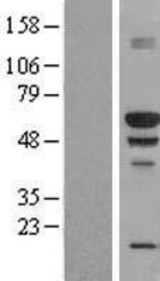 Western Blot: BANP Overexpression Lysate (Adult Normal) [NBP2-09955] Left-Empty vector transfected control cell lysate (HEK293 cell lysate); Right -Over-expression Lysate for BANP.