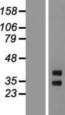 Western Blot: SHOX2 Overexpression Lysate (Adult Normal) [NBP2-07568] Left-Empty vector transfected control cell lysate (HEK293 cell lysate); Right -Over-expression Lysate for SHOX2.