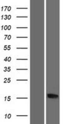 Western Blot: RPS20 Overexpression Lysate (Adult Normal) [NBP2-10138] Left-Empty vector transfected control cell lysate (HEK293 cell lysate); Right -Over-expression Lysate for RPS20.