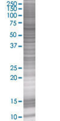 RANGAP1 transfected lysate.