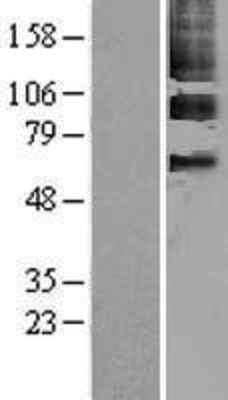 Western Blot: PPAR gamma Overexpression Lysate (Adult Normal) [NBL1-14633] Left-Empty vector transfected control cell lysate (HEK293 cell lysate); Right -Over-expression Lysate for PPAR gamma.