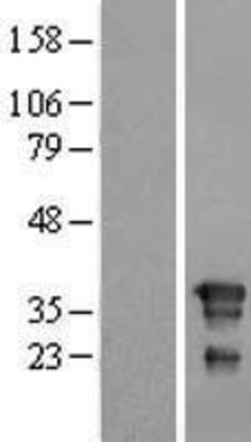 Western Blot: FNDC8 Overexpression Lysate (Adult Normal) [NBL1-10787] Left-Empty vector transfected control cell lysate (HEK293 cell lysate); Right -Over-expression Lysate for FNDC8.