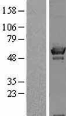 Western Blot: OXSR1 Overexpression Lysate (Adult Normal) [NBL1-14025] Left-Empty vector transfected control cell lysate (HEK293 cell lysate); Right -Over-expression Lysate for OXSR1.