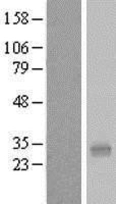 Western Blot: PQLC1 Overexpression Lysate (Adult Normal) [NBL1-14718] Left-Empty vector transfected control cell lysate (HEK293 cell lysate); Right -Over-expression Lysate for PQLC1.
