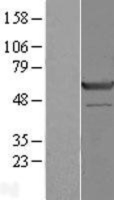 Western Blot: SGK3 Overexpression Lysate (Adult Normal) [NBL1-15909] Left-Empty vector transfected control cell lysate (HEK293 cell lysate); Right -Over-expression Lysate for SGK3.