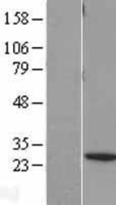 Western Blot: BNIP1 Overexpression Lysate (Adult Normal) [NBL1-08012] Left-Empty vector transfected control cell lysate (HEK293 cell lysate); Right -Over-expression Lysate for BNIP1.