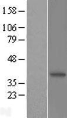 Western Blot: N myc interactor Overexpression Lysate (Adult Normal) [NBL1-13690] Left-Empty vector transfected control cell lysate (HEK293 cell lysate); Right -Over-expression Lysate for N myc interactor.