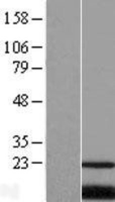 Western Blot: PQLC2 Overexpression Lysate (Adult Normal) [NBL1-14719] Left-Empty vector transfected control cell lysate (HEK293 cell lysate); Right -Over-expression Lysate for PQLC2.