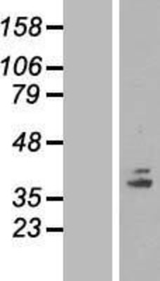 Western Blot: COQ5 Overexpression Lysate (Adult Normal) [NBL1-09391] Left-Empty vector transfected control cell lysate (HEK293 cell lysate); Right -Over-expression Lysate for COQ5.