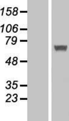 Western Blot: IFIT5 Overexpression Lysate (Adult Normal) [NBL1-11838] Left-Empty vector transfected control cell lysate (HEK293 cell lysate); Right -Over-expression Lysate for IFIT5.