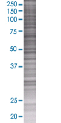 ARHGAP9 transfected lysate.