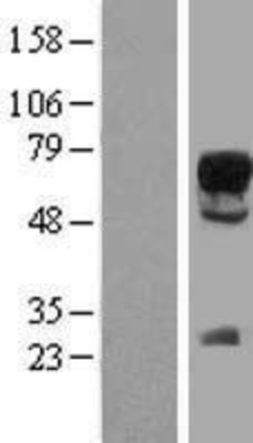 Western Blot: SOX9 Overexpression Lysate (Adult Normal) [NBP2-09033] Left-Empty vector transfected control cell lysate (HEK293 cell lysate); Right -Over-expression Lysate for SOX9.