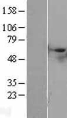 Western Blot: STK40 Overexpression Lysate (Adult Normal) [NBL1-16556] Left-Empty vector transfected control cell lysate (HEK293 cell lysate); Right -Over-expression Lysate for STK40.