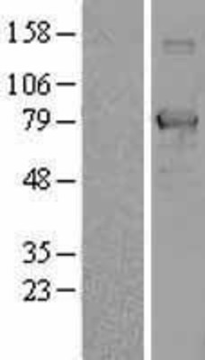 Western Blot: NULP1 Overexpression Lysate (Adult Normal) [NBL1-16773] Left-Empty vector transfected control cell lysate (HEK293 cell lysate); Right -Over-expression Lysate for NULP1.