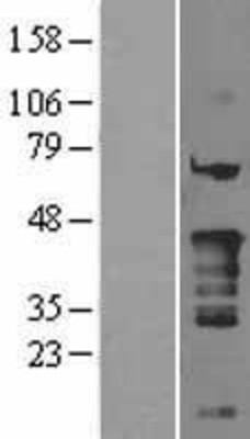Western Blot: Nkx2.5 Overexpression Lysate (Adult Normal) [NBL1-13659] Left-Empty vector transfected control cell lysate (HEK293 cell lysate); Right -Over-expression Lysate for Nkx2.5.