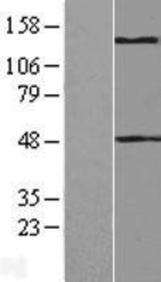 Western Blot: TLR7 Overexpression Lysate (Adult Normal) [NBL1-16956] Left-Empty vector transfected control cell lysate (HEK293 cell lysate); Right -Over-expression Lysate for TLR7.