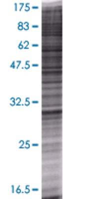 SETD4 transfected lysate.