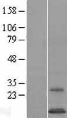 Western Blot: SYS1 Overexpression Lysate (Adult Normal) [NBL1-16646] Left-Empty vector transfected control cell lysate (HEK293 cell lysate); Right -Over-expression Lysate for SYS1.