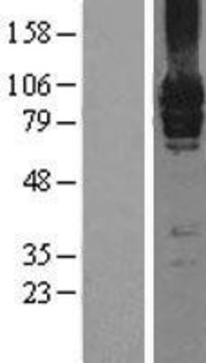 Western Blot: mGluR7 Overexpression Lysate (Adult Normal) [NBL1-11351] Left-Empty vector transfected control cell lysate (HEK293 cell lysate); Right -Over-expression Lysate for mGluR7.