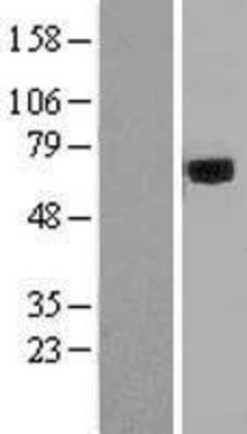 Western Blot: Acyloxyacyl Hydrolase Overexpression Lysate (Adult Normal) [NBL1-07569] Left-Empty vector transfected control cell lysate (HEK293 cell lysate); Right -Over-expression Lysate for Acyloxyacyl Hydrolase.