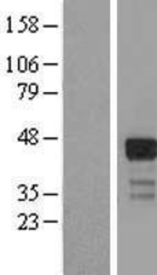 Western Blot: RNF126 Overexpression Lysate (Adult Normal) [NBL1-15418] Left-Empty vector transfected control cell lysate (HEK293 cell lysate); Right -Over-expression Lysate for RNF126.