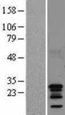 Western Blot: AKIP1/BCA3 Overexpression Lysate (Adult Normal) [NBL1-08095] Left-Empty vector transfected control cell lysate (HEK293 cell lysate); Right -Over-expression Lysate for AKIP1/BCA3.