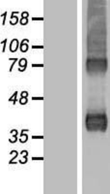 Western Blot: actin-related protein 2/3 complex subunit 1B Overexpression Lysate (Adult Normal) [NBL1-07726] Left-Empty vector transfected control cell lysate (HEK293 cell lysate); Right -Over-expression Lysate for actin-related protein 2/3 complex subunit 1B.