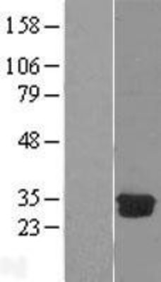 Western Blot: DCK Overexpression Lysate (Adult Normal) [NBL1-09740] Left-Empty vector transfected control cell lysate (HEK293 cell lysate); Right -Over-expression Lysate for DCK.
