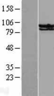 Western Blot: STAT6 Overexpression Lysate (Adult Normal) [NBL1-16529] Left-Empty vector transfected control cell lysate (HEK293 cell lysate); Right -Over-expression Lysate for STAT6.