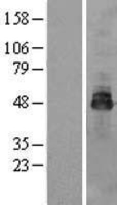 Western Blot: OSTM1 Overexpression Lysate (Adult Normal) [NBL1-14006] Left-Empty vector transfected control cell lysate (HEK293 cell lysate); Right -Over-expression Lysate for OSTM1.