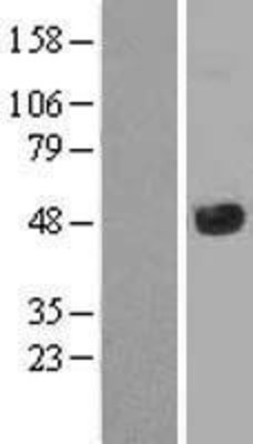 Western Blot: JMJD5 Overexpression Lysate (Adult Normal) [NBL1-12106] Left-Empty vector transfected control cell lysate (HEK293 cell lysate); Right -Over-expression Lysate for JMJD5.