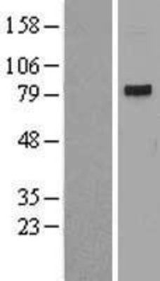 Western Blot: CDT2 Overexpression Lysate (Adult Normal) [NBL1-10031] Left-Empty vector transfected control cell lysate (HEK293 cell lysate); Right -Over-expression Lysate for CDT2.