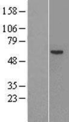 Western Blot: Factor IX Overexpression Lysate (Adult Normal) [NBL1-10414] Left-Empty vector transfected control cell lysate (HEK293 cell lysate); Right -Over-expression Lysate for Factor IX.