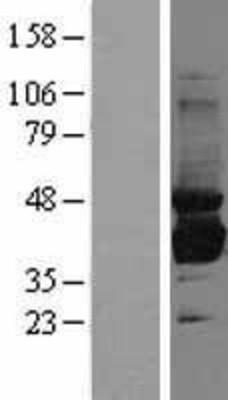 Western Blot: Sorbitol Dehydrogenase Overexpression Lysate (Adult Normal) [NBL1-16339] Left-Empty vector transfected control cell lysate (HEK293 cell lysate); Right -Over-expression Lysate for Sorbitol Dehydrogenase.