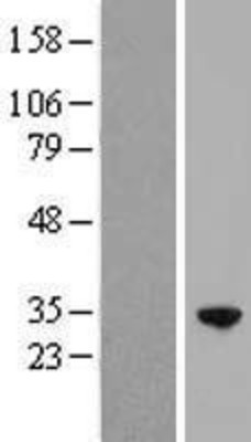 Western Blot: RFXANK Overexpression Lysate (Adult Normal) [NBP2-07963] Left-Empty vector transfected control cell lysate (HEK293 cell lysate); Right -Over-expression Lysate for RFXANK.