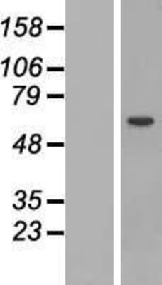 Western Blot: STAM Overexpression Lysate (Adult Normal) [NBP2-08004] Left-Empty vector transfected control cell lysate (HEK293 cell lysate); Right -Over-expression Lysate for STAM.