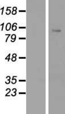 Western Blot: CLOCK Overexpression Lysate (Adult Normal) [NBP2-07811] Left-Empty vector transfected control cell lysate (HEK293 cell lysate); Right -Over-expression Lysate for CLOCK.