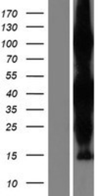 Western Blot: ZC3HAV1L Overexpression Lysate (Adult Normal) [NBP2-05740] Left-Empty vector transfected control cell lysate (HEK293 cell lysate); Right -Over-expression Lysate for ZC3HAV1L.