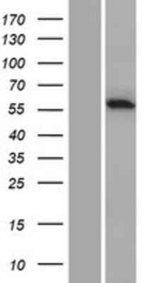 Western Blot: CARD9 Overexpression Lysate (Adult Normal) [NBP2-05865] Left-Empty vector transfected control cell lysate (HEK293 cell lysate); Right -Over-expression Lysate for CARD9.